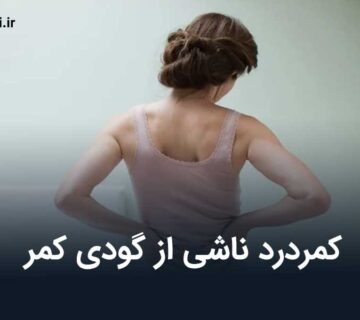 کمردرد ناشی از گودی کمر