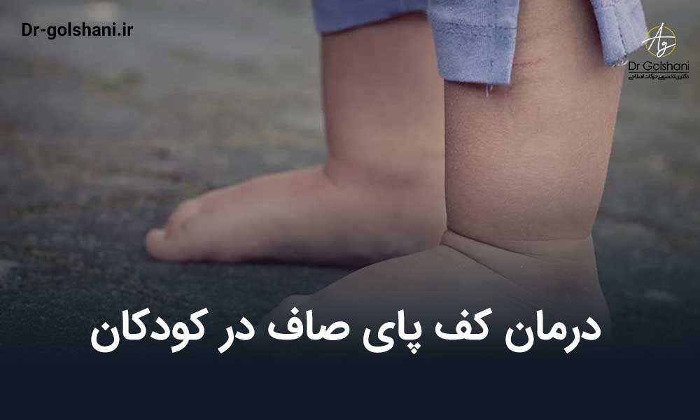 درمان کف پای صاف در کودکان