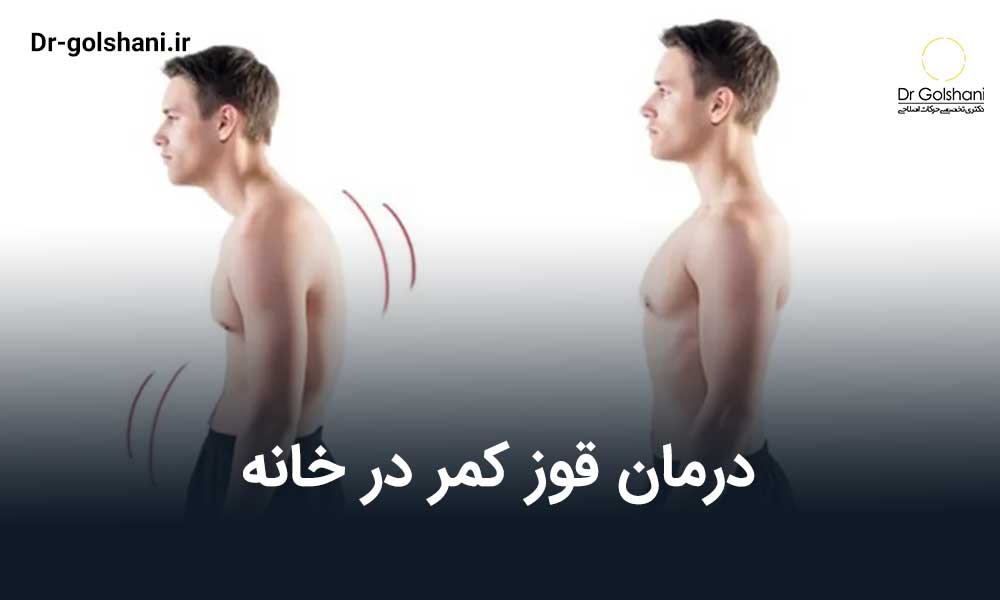 درمان قوز کمر در خانه