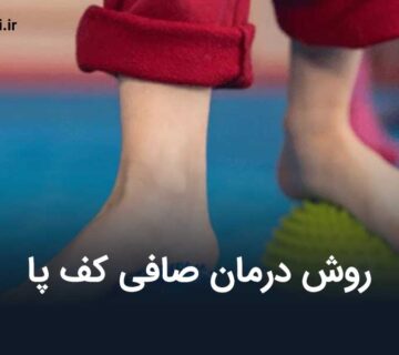درمان صافی کف پا
