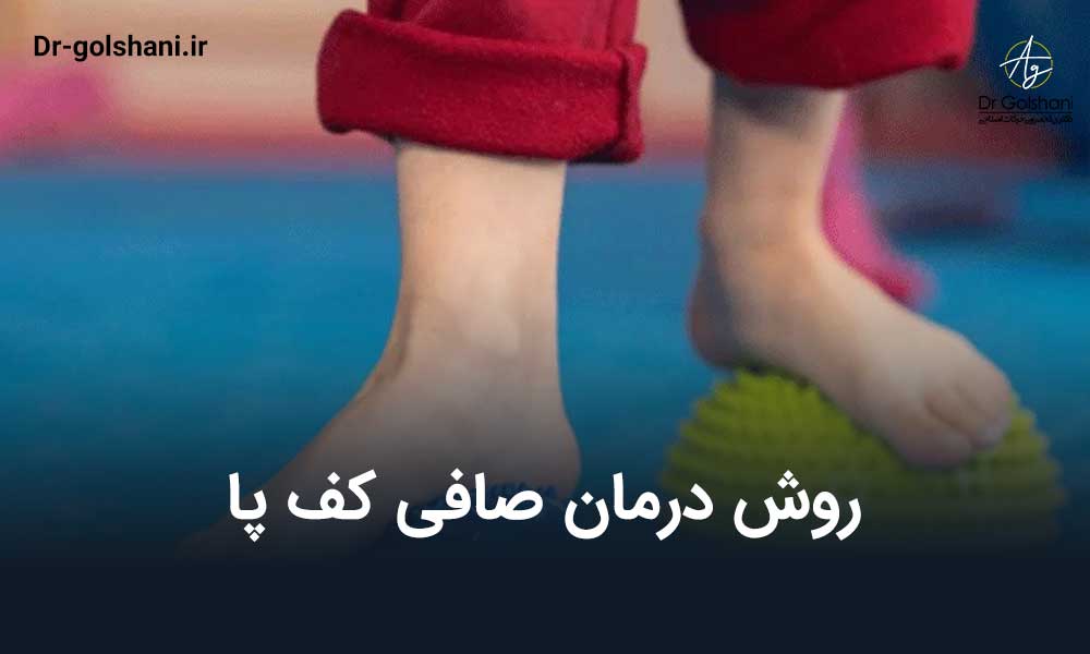 درمان صافی کف پا