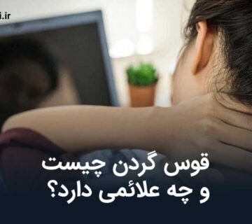 قوس گردن چیست؟