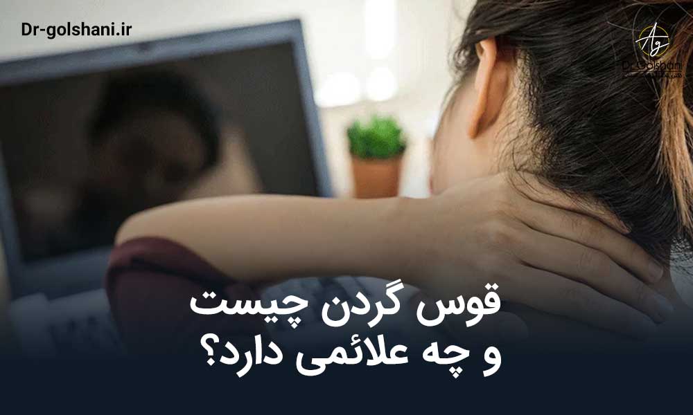 قوس گردن چیست؟
