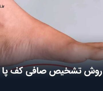 روش تشخیص صافی کف پا