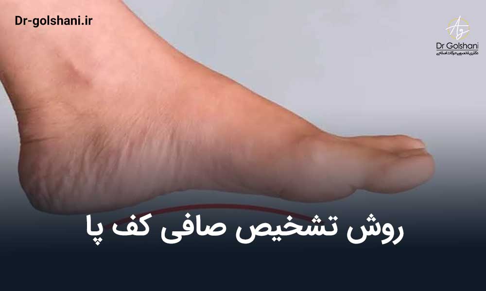 روش تشخیص صافی کف پا