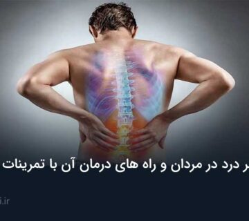 علت کمر درد در مردان