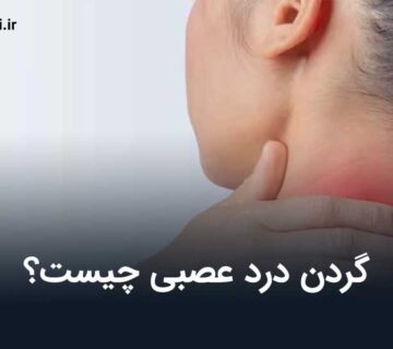 گردن درد عصبی چیست؟