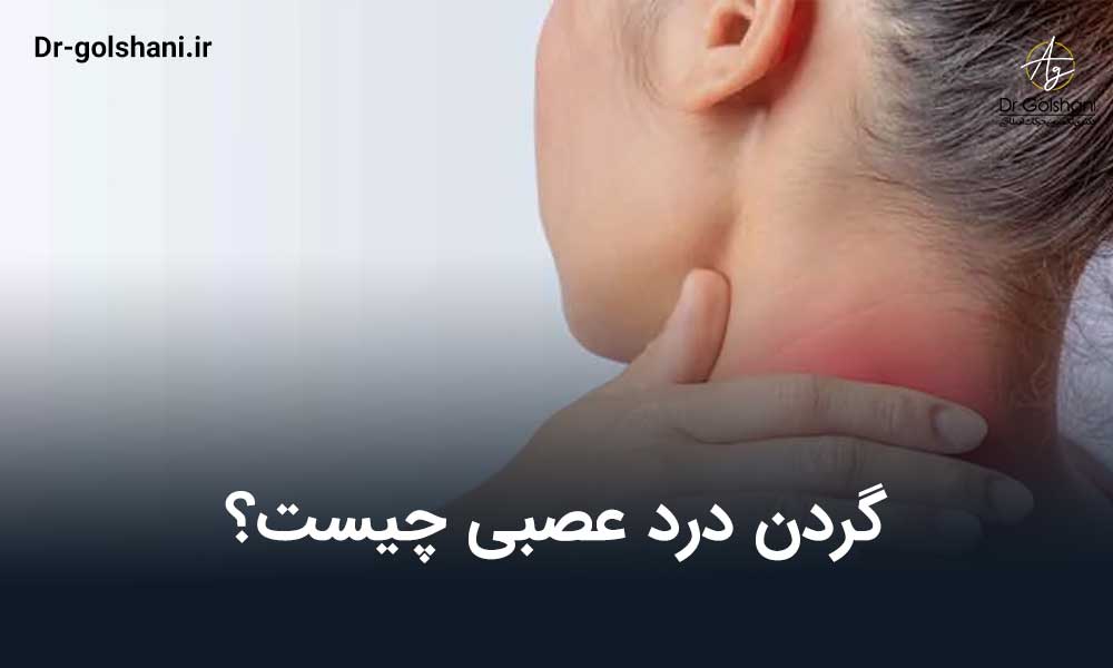 گردن درد عصبی چیست؟