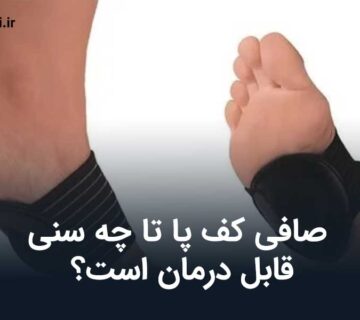 صافی کف پا تا چه سنی قابل درمان است