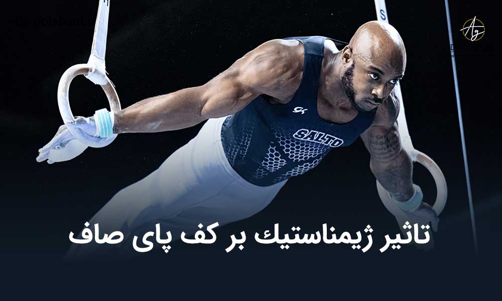 تاثیر ژيمناستيك بر كف پای صاف