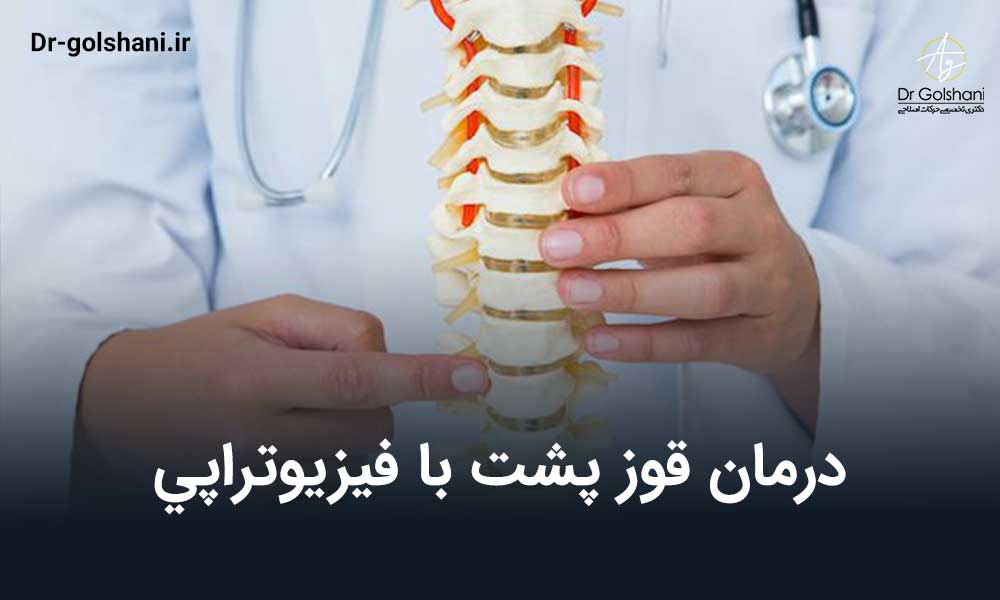 درمان قوز پشت با فيزيوتراپي