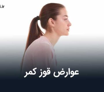 عوارض قوز کمر
