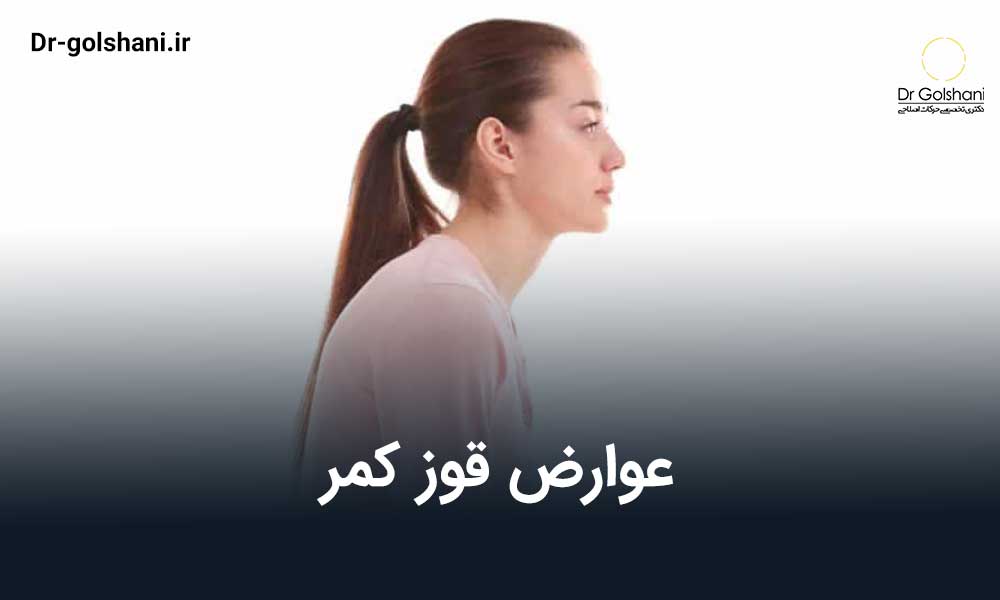 عوارض قوز کمر