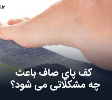 عوارض کف پای صاف