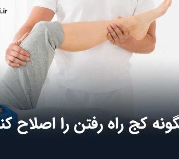 چگونه کج راه رفتن را اصلاح کنیم