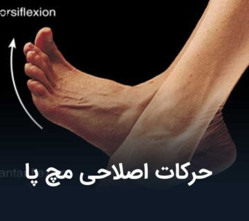 حرکات اصلاحی مچ پا