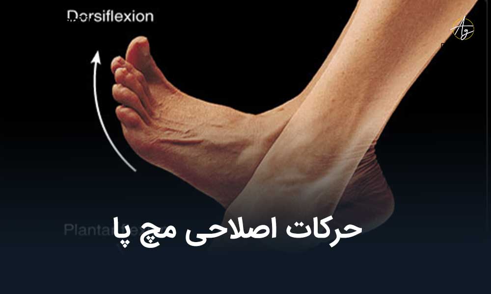 حرکات اصلاحی مچ پا