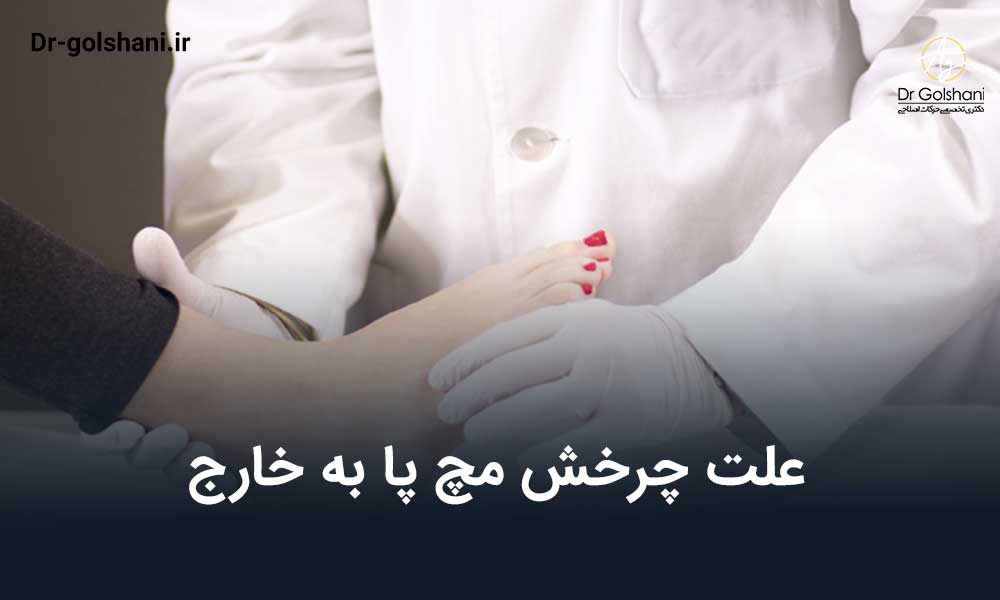 علت چرخش مچ پا به خارج