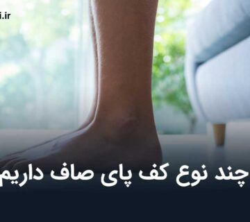 چند نوع کف پای صاف داریم؟