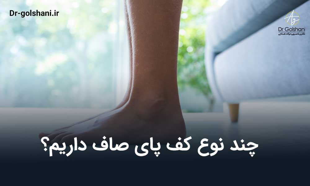 چند نوع کف پای صاف داریم؟