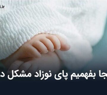 از کجا بفهمیم پای نوزاد مشکل دارد؟