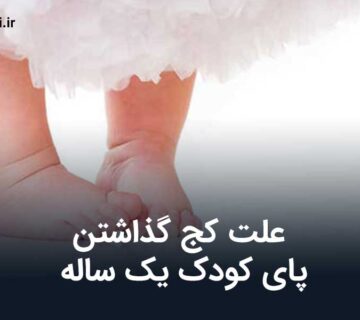 علت کج گذاشتن پای کودک یک ساله