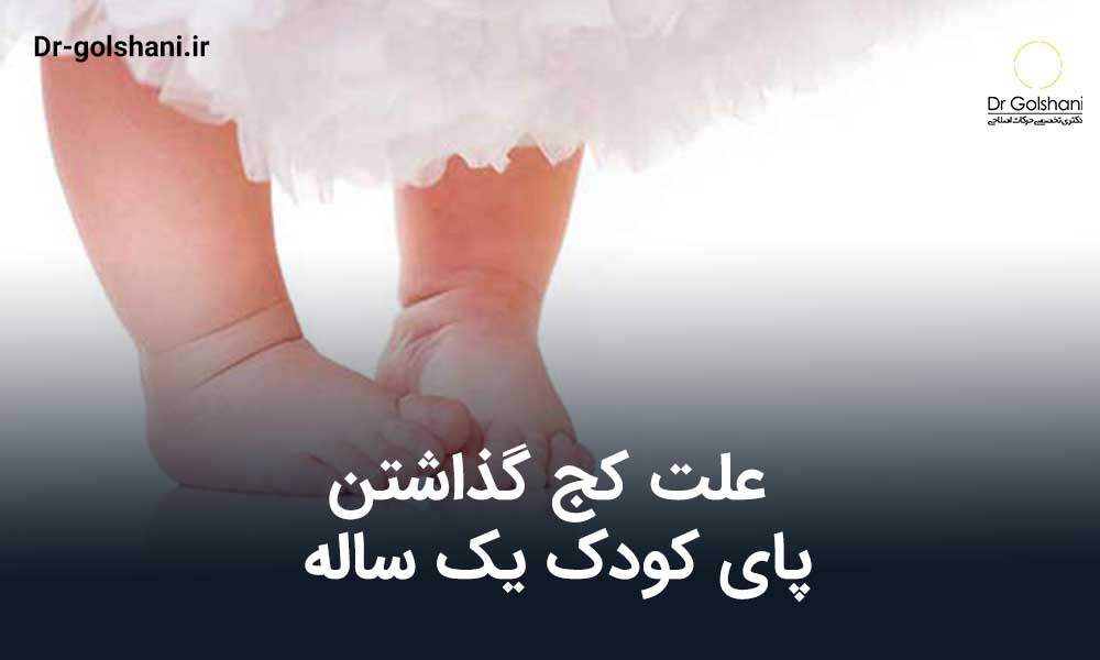 علت کج گذاشتن پای کودک یک ساله