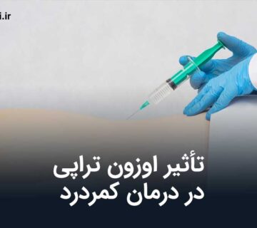 تأثیر اوزون تراپی در درمان کمردرد