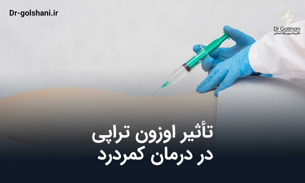 تأثیر اوزون تراپی در درمان کمردرد