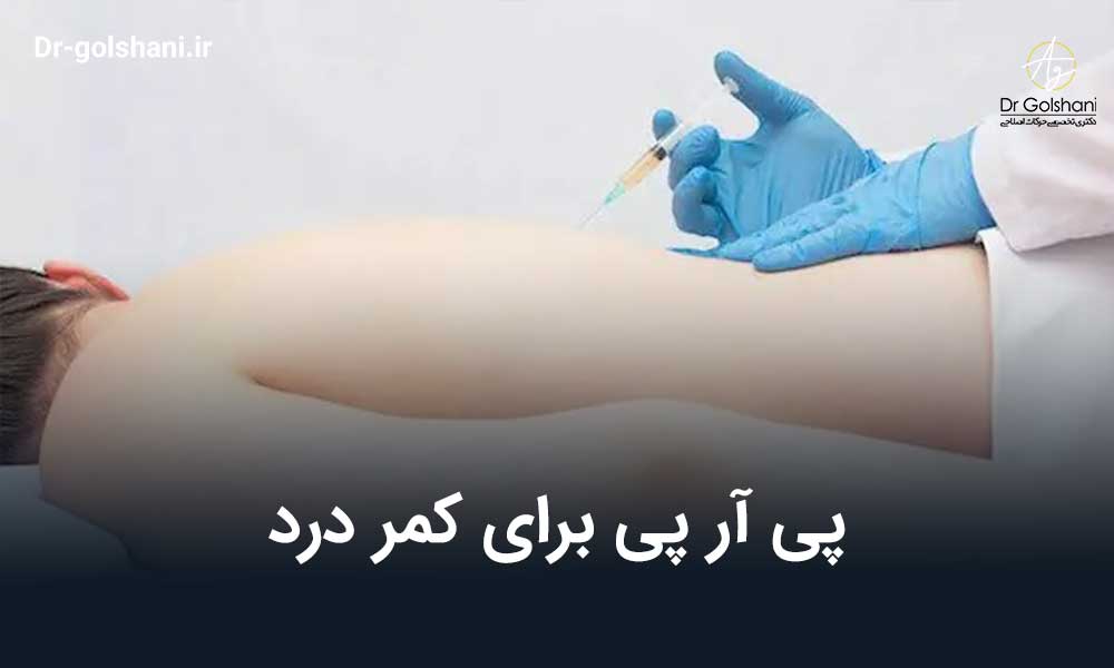 پی آر پی برای کمر درد