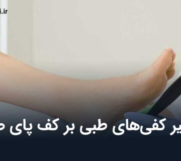 تاثیر کفی‌های طبی بر کف پای صاف