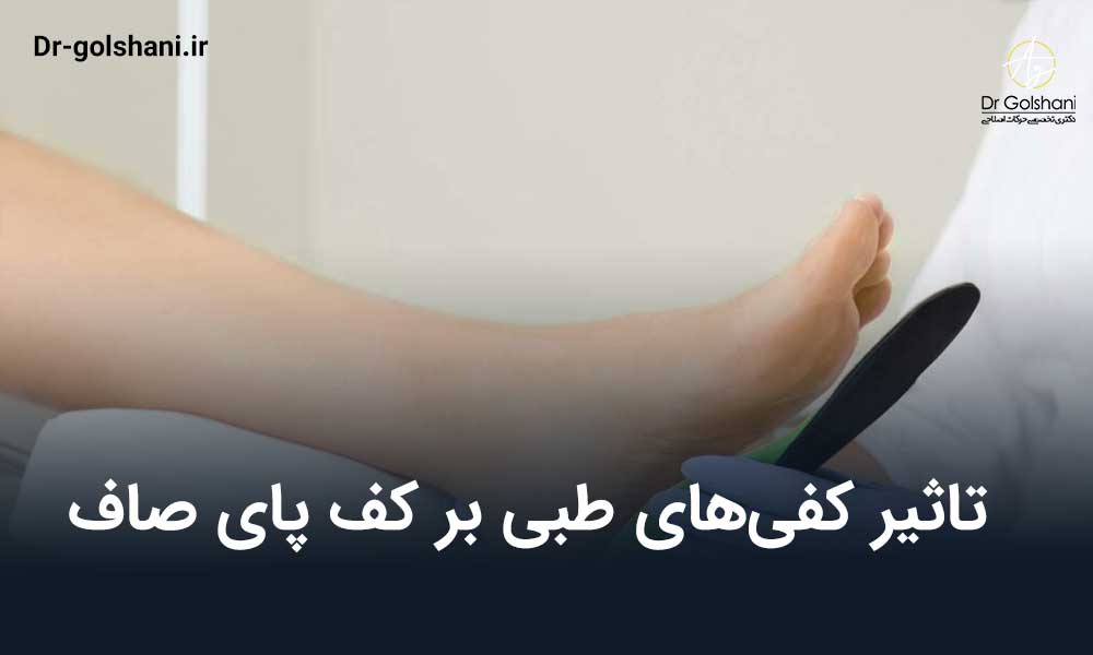 تاثیر کفی‌های طبی بر کف پای صاف