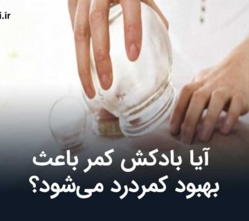 آیا بادکش کمر باعث بهبود کمردرد می‌شود؟