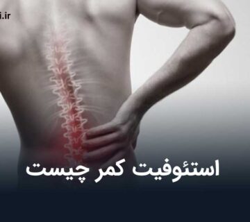 استئوفیت کمر چیست