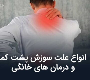 انواع علت سوزش پشت کمر + [درمان های خانگی برای رفع آن]