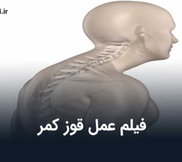 فیلم عمل قوز کمر