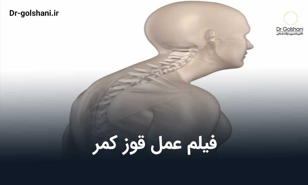 فیلم عمل قوز کمر