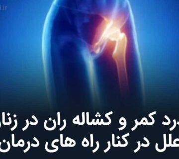 درد کمر و کشاله ران در زنان