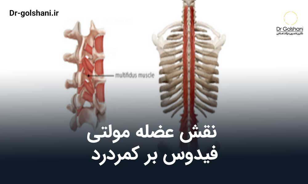 نقش عضله مولتی فیدوس بر کمردرد