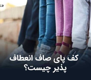 کف پای صاف انعطاف پذیر چیست؟