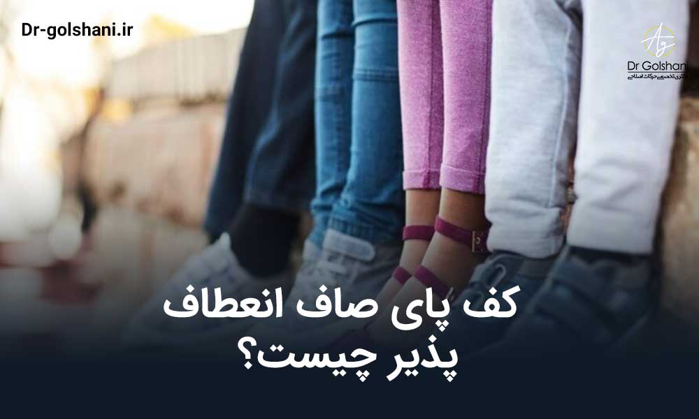 کف پای صاف انعطاف پذیر چیست؟