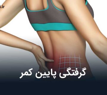 گرفتگی پایین کمر