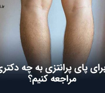 برای پای پرانتزی به چه دکتری مراجعه کنیم؟