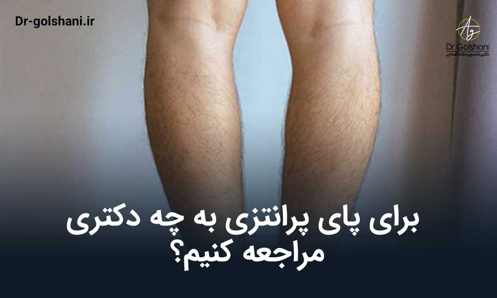 برای پای پرانتزی به چه دکتری مراجعه کنیم؟