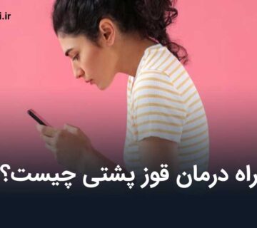 درمان قوز پشتی