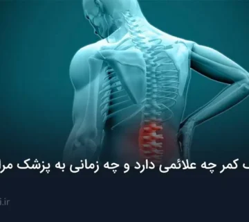 فتق دیسک کمر
