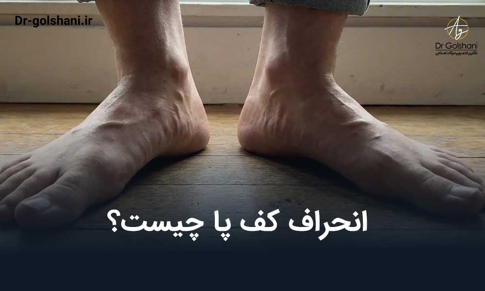 انحراف کف پا چیست و چگونه ایجاد می‌شود؟