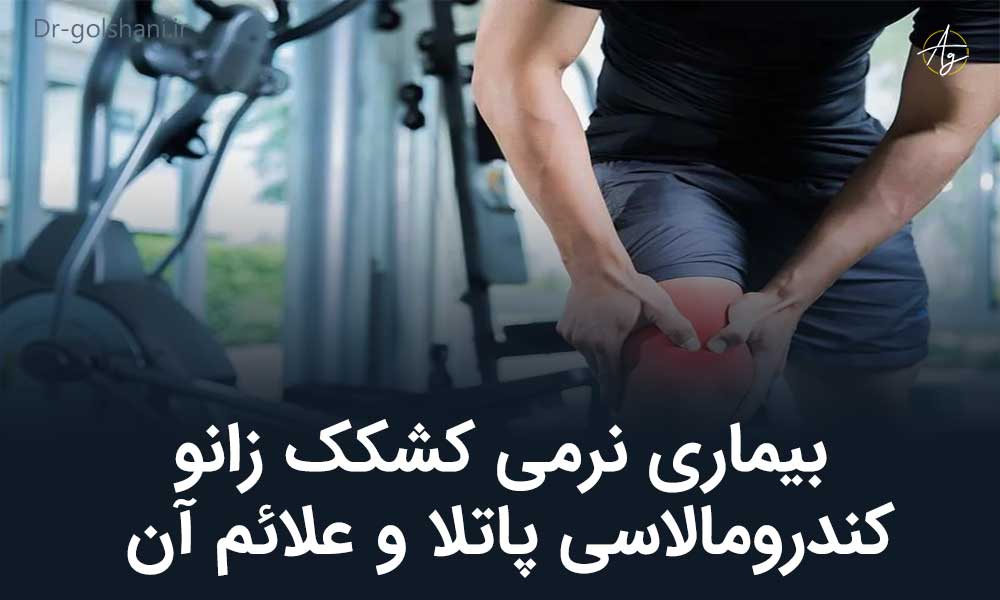 بیماری نرمی کشکک زانو یا کندرومالاسی پاتلا و علائم آن