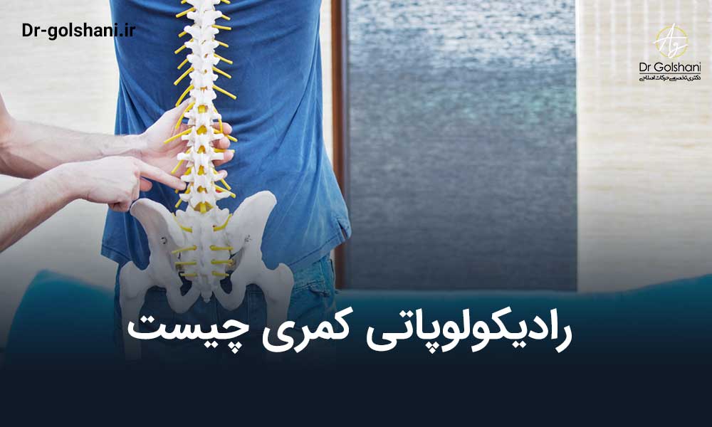 رادیکولوپاتی کمری چیست و بهترین روش درمان آن چگونه است؟