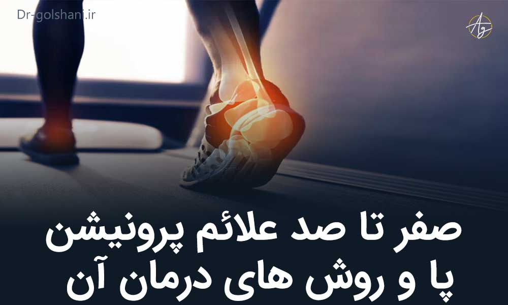 صفر تا صد علائم پرونیشن پا و روش های درمان آن